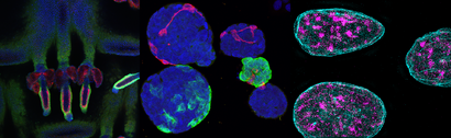 Mechanical-stress induced DNA damage and genome mechanoprotection in cellular and organismal homeostasis